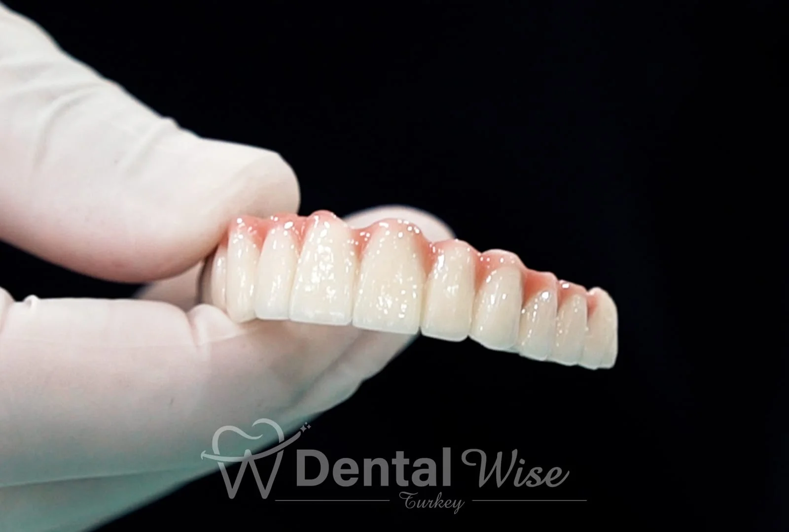 How does the All-on-5 work and how long does it take? How many visits are needed?