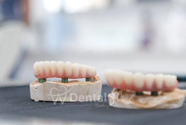 How Is All on 4 Done?