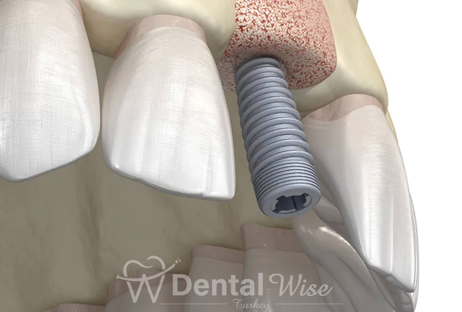 Technological Advancements in Surgery Procedures