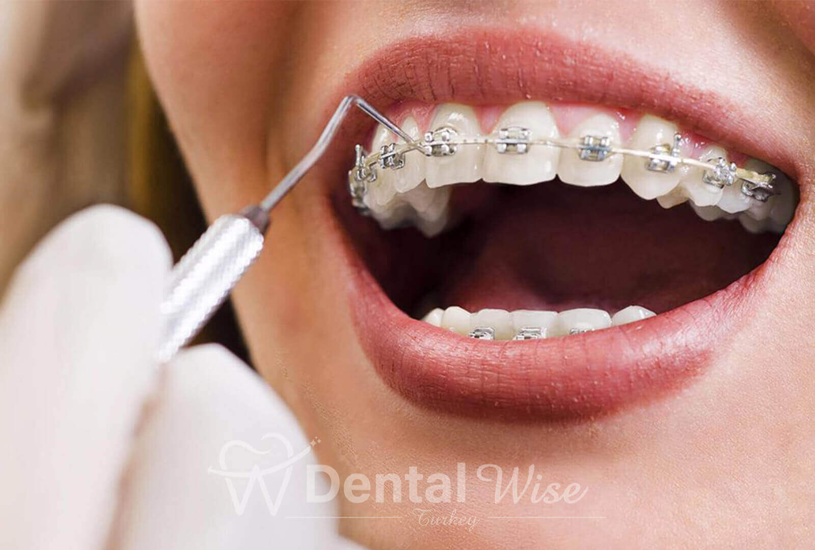 What are Ortodotic Treatments?