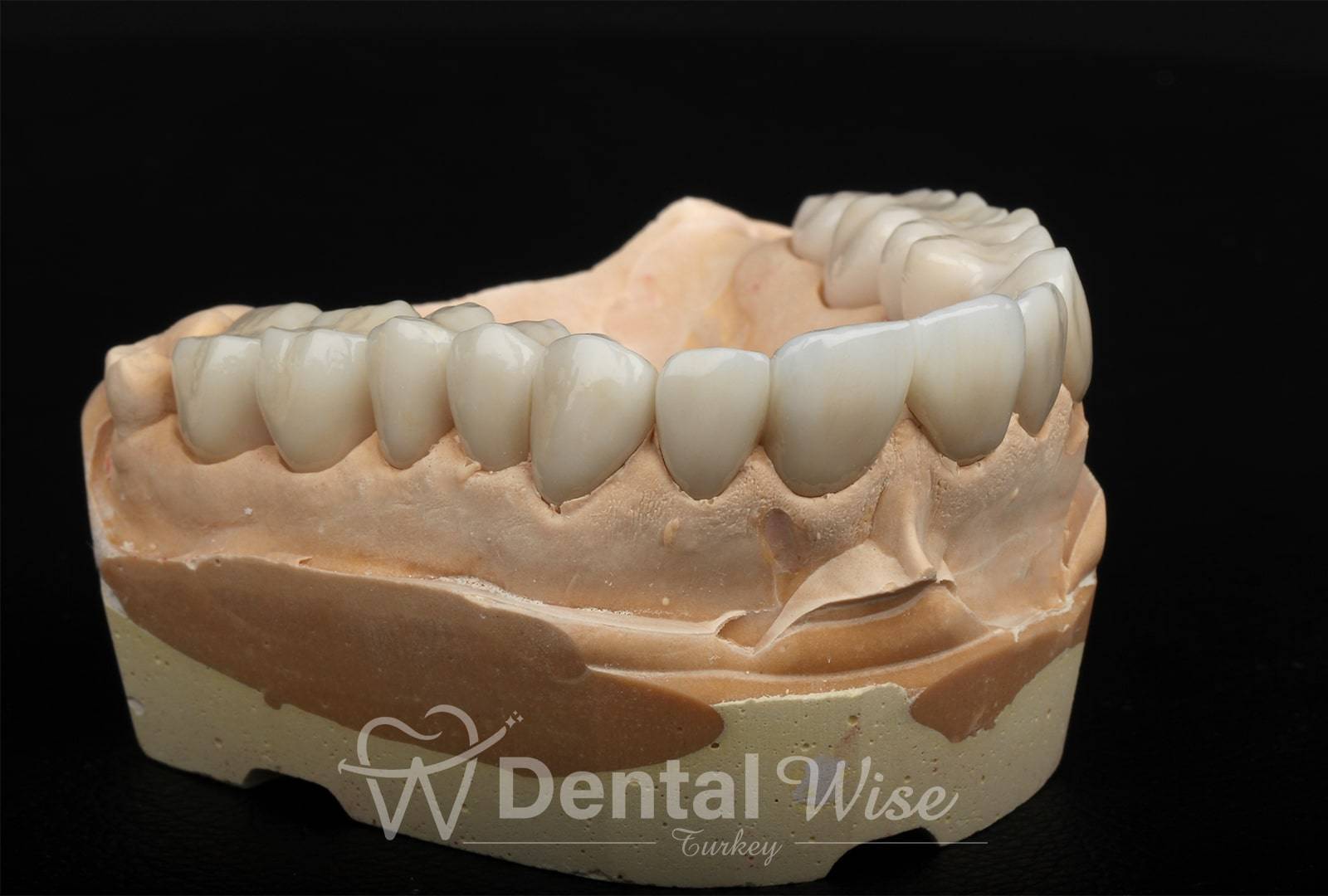 What is a Dental Prosthesis?