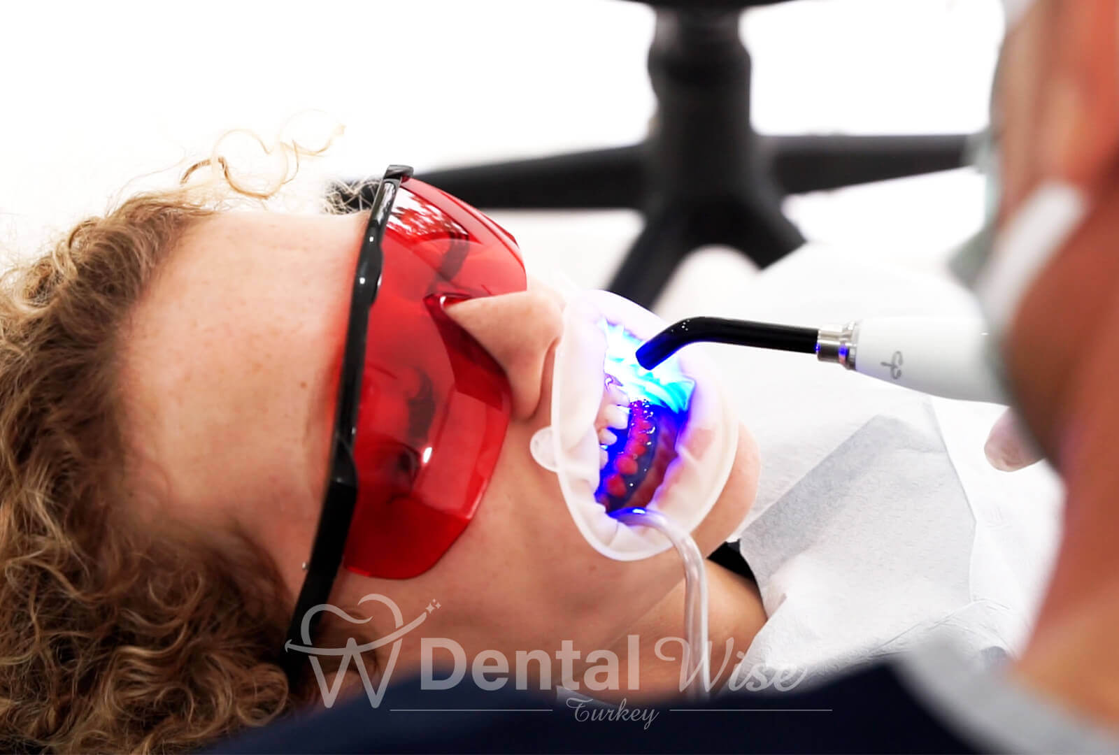 The Benefits Of Teeth Whitening