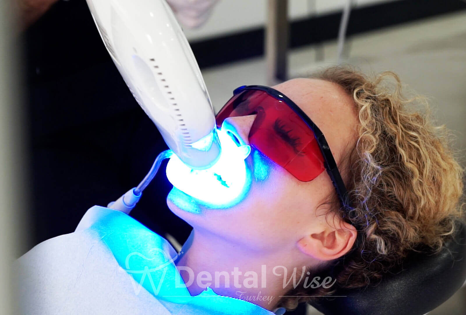 Importance Of Professional Whitening Treatment