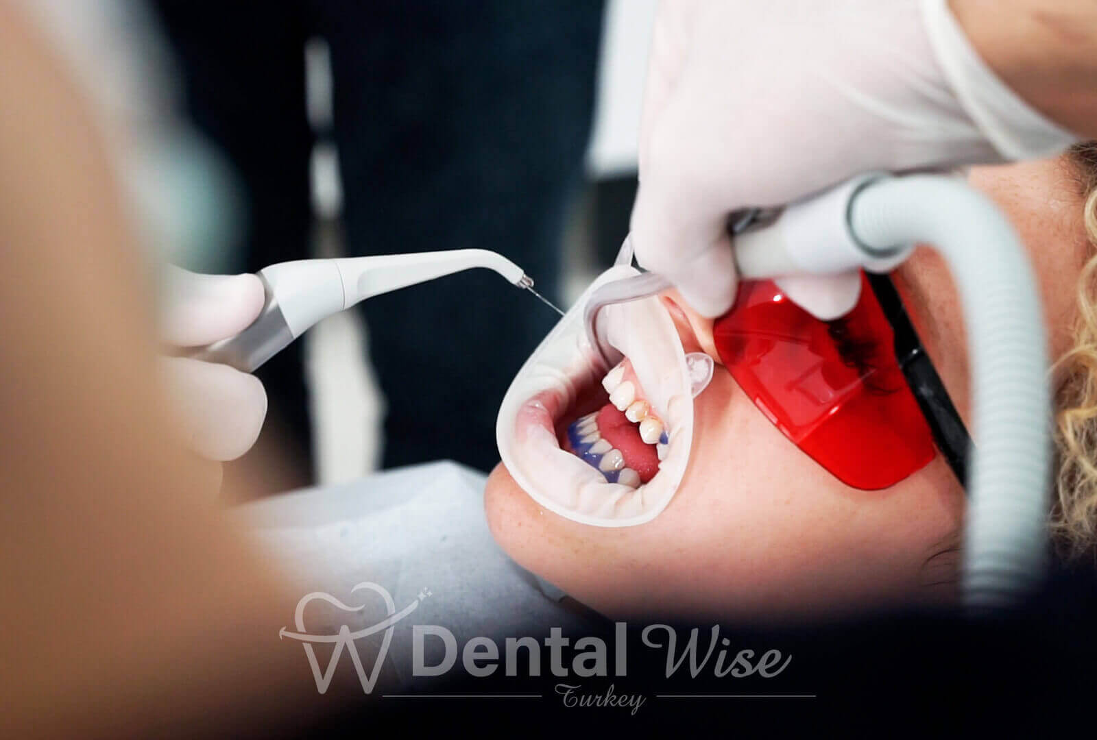 The Process Of Professional Teeth Whitening