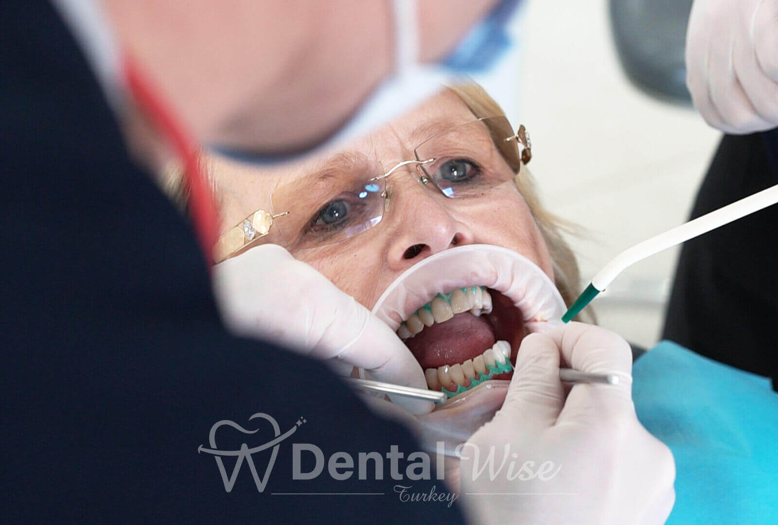 The Role Of Diet In Maintaining White Teeth