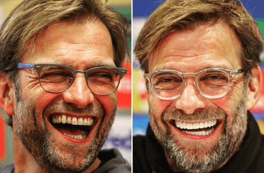 Jürgen Klopp Teeth