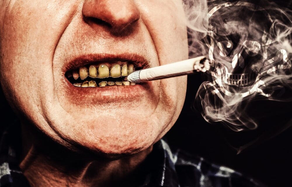 The Harmful Effects Of Smoking on Oral Health